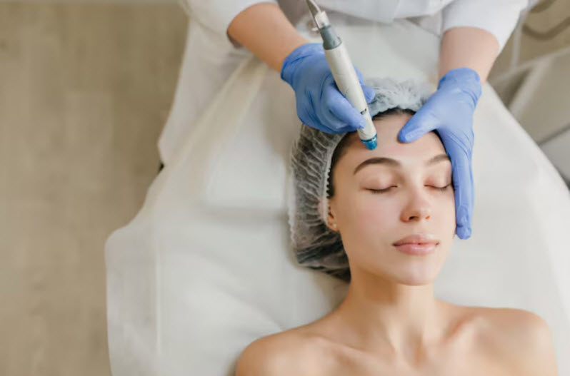 Microneedling Maple Ridge